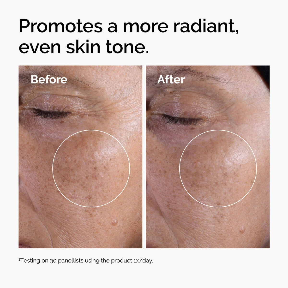 The Ordinary Acido Gilcolico 7%