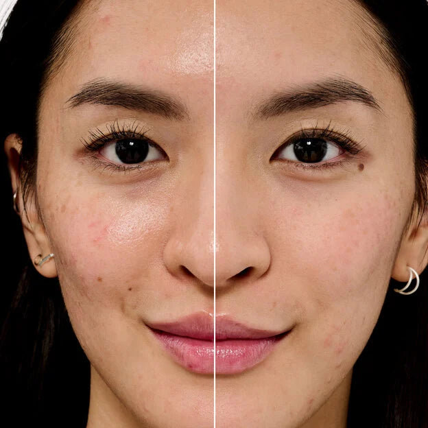 Benefit Primer