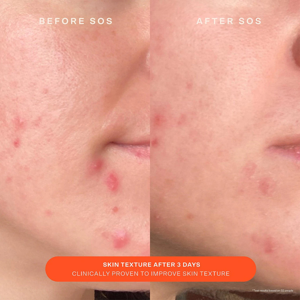 Tower 28 SOS Recovery Moisturizer