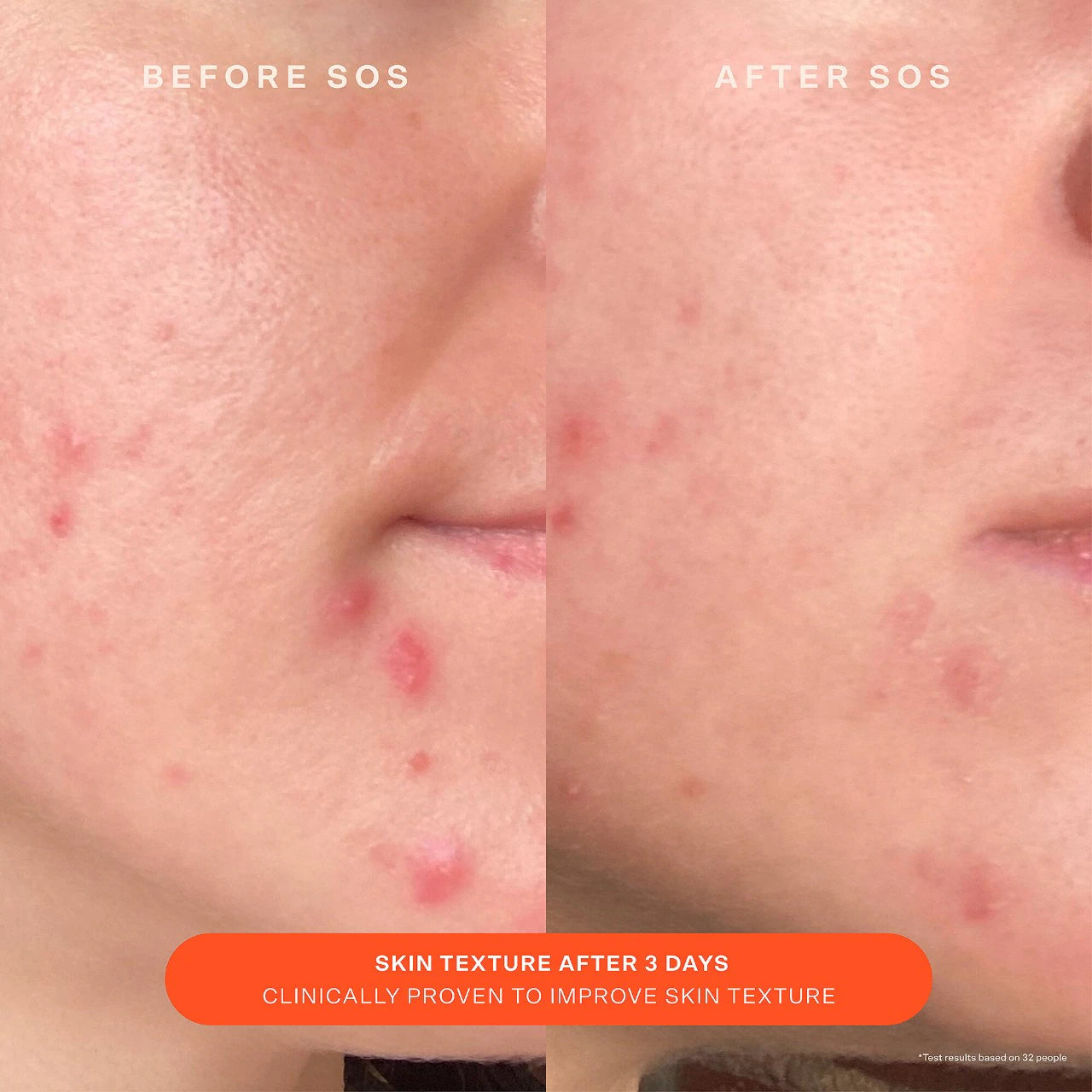 Tower 28 SOS Recovery Moisturizer