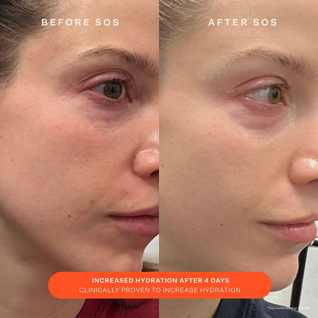 Tower 28 SOS Recovery Moisturizer